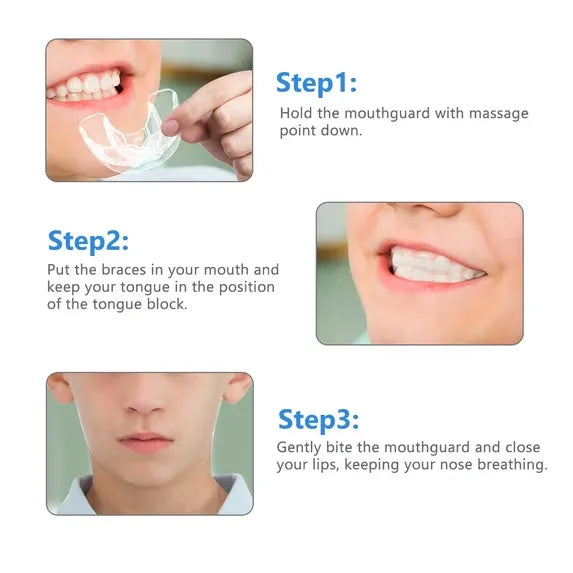 Gouttière Dentaire Transparente en Silicone – Correction du Sourire en 3 Étapes