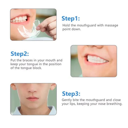 Gouttière Dentaire Transparente en Silicone – Correction du Sourire en 3 Étapes