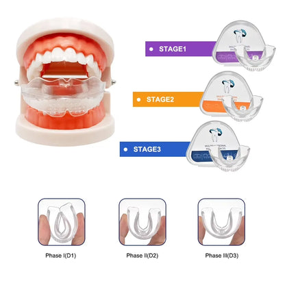 Gouttière Dentaire Transparente en Silicone – Correction du Sourire en 3 Étapes