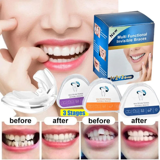 Gouttière Dentaire Transparente en Silicone – Correction du Sourire en 3 Étapes